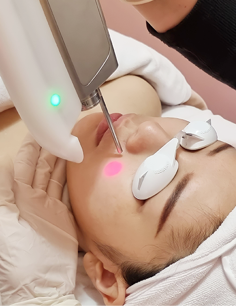 Woman undergoing botox process.