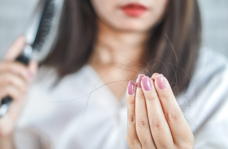 Woman with hair loss problem.