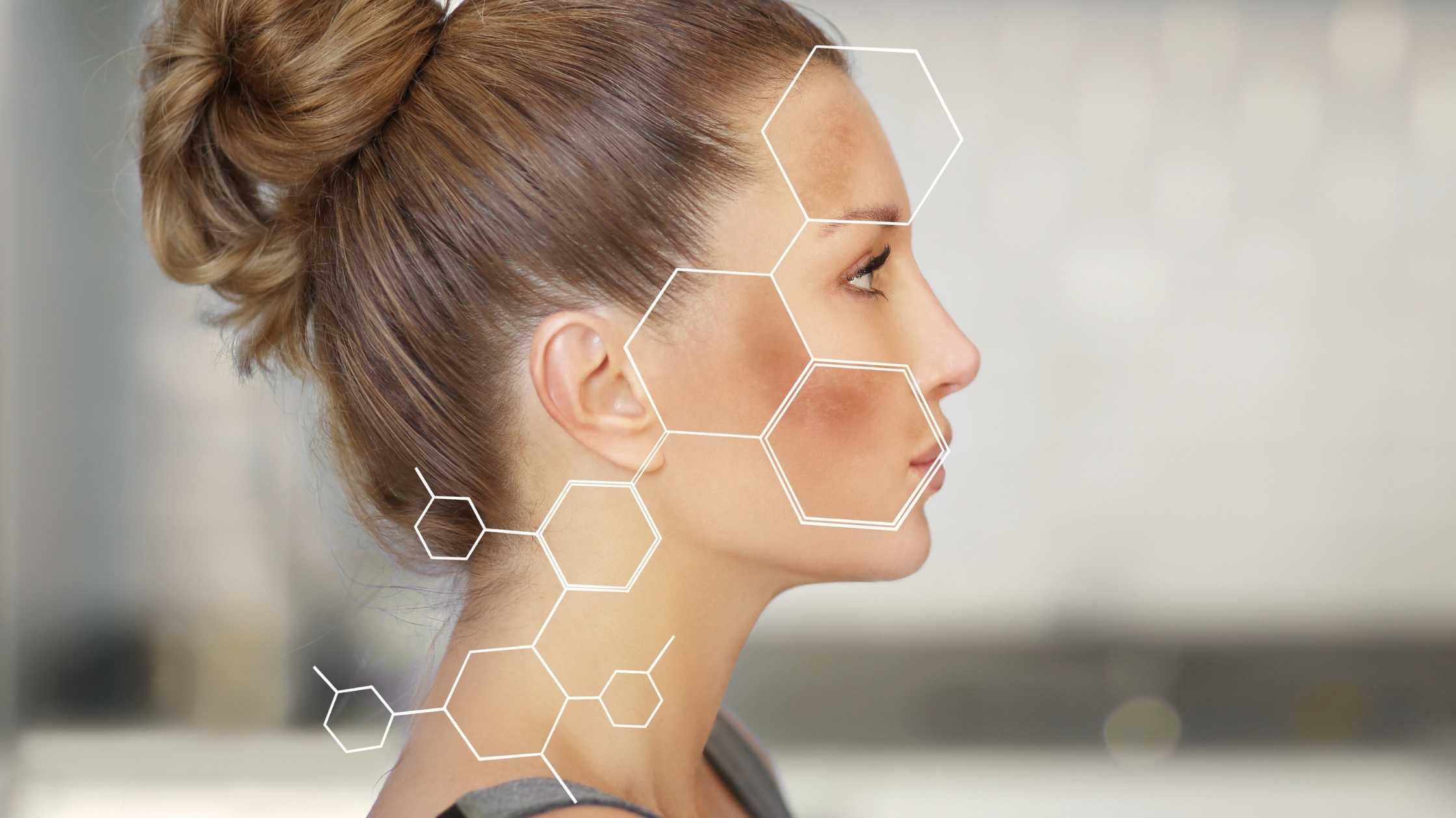 2026 Guide to Effective Pigmentation Laser Treatment in Singapore