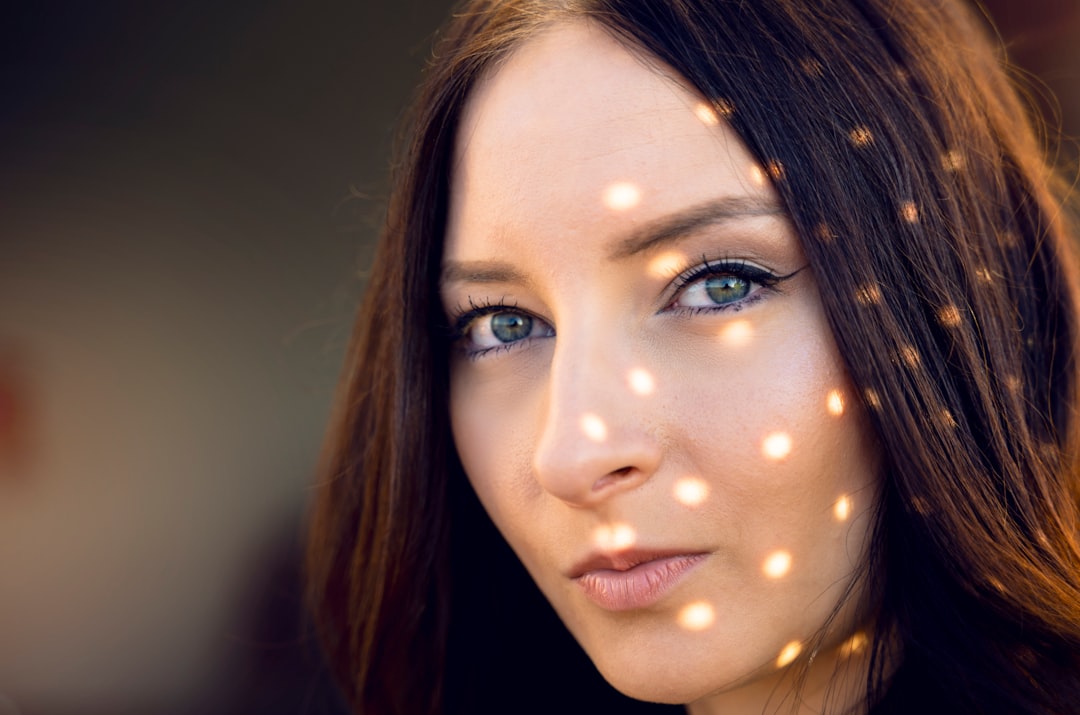 Photo laser pigmentation removal