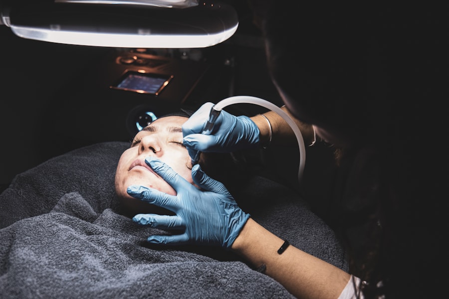 Photo laser treatment