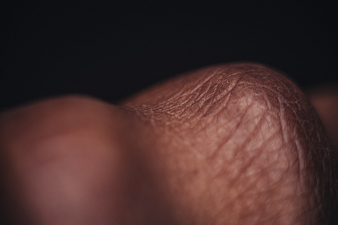 Photo sagging skin