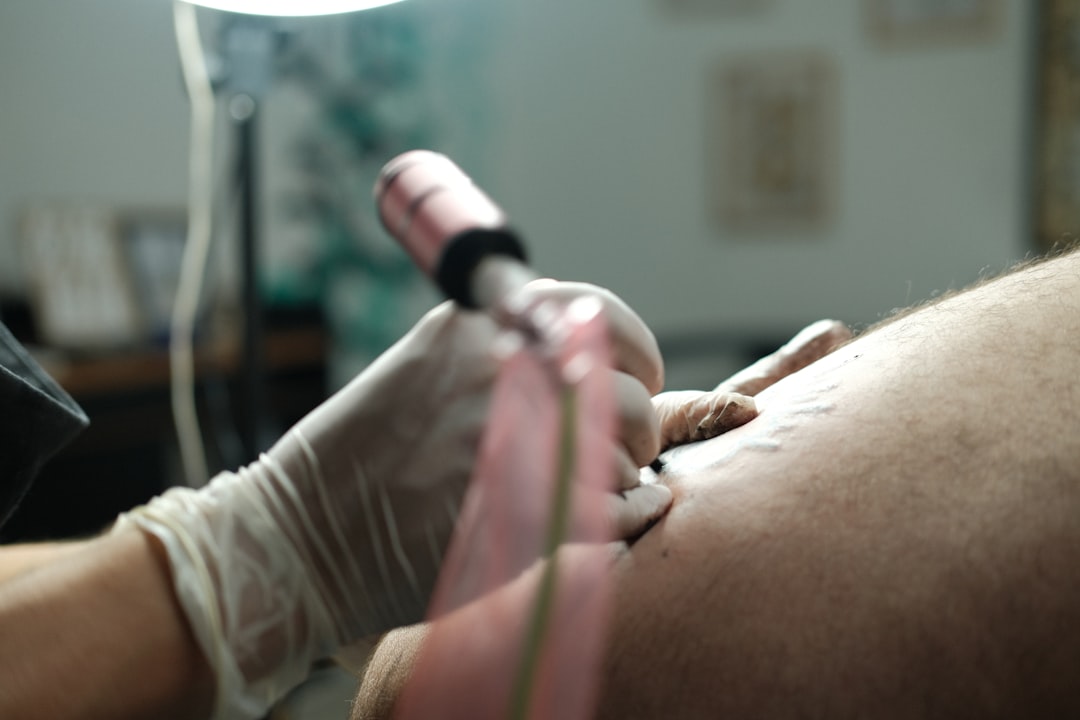 Photo laser treatment