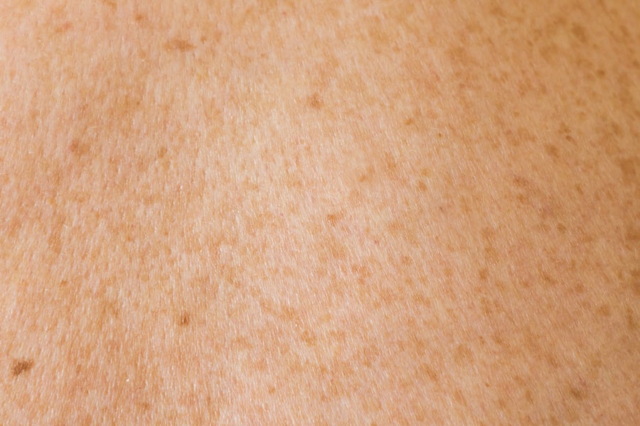 dermatology