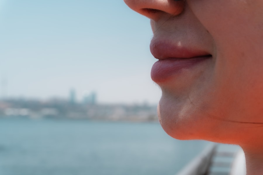 lip filler clinic