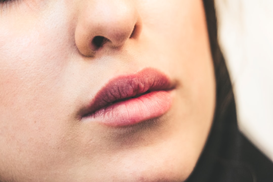 Photo lip filler clinic